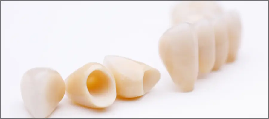 セラミック人工歯